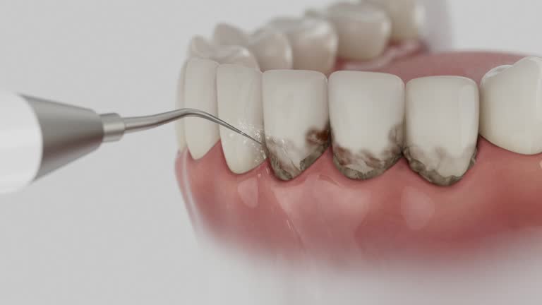 Reliable Dental Implants contractor in Premont, TX by Smile Center Dentistry